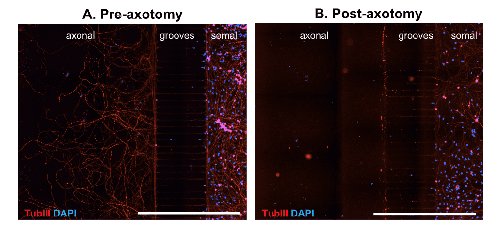 axonal injury and growth