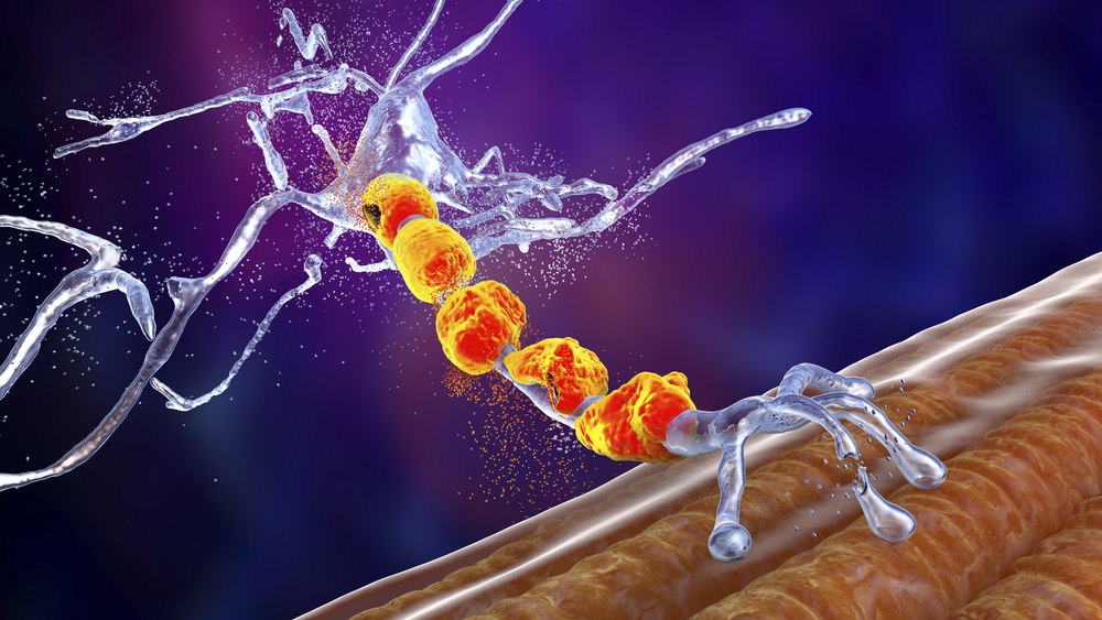 Graphic illustration of degradation of motor neurons