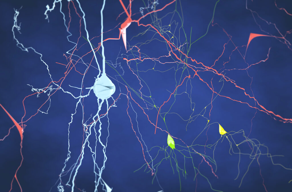 neural network in brain, parkinsons disease