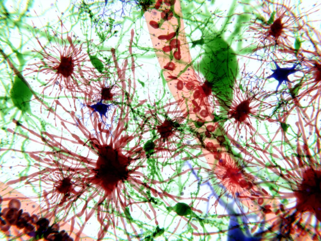 Brain cells - astrocytes, pyramidal neurons, microglia cells